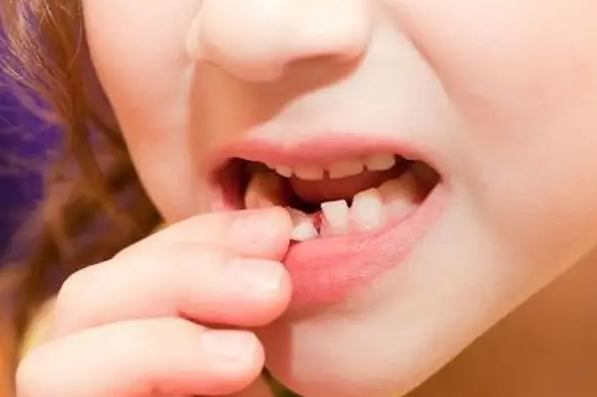 银耳|人到中年,牙龈萎缩,烦恼加倍,每天注意3点预防,远离拔牙不是梦