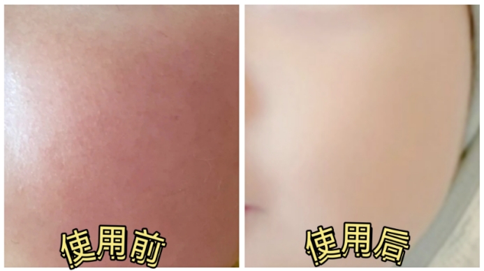 面霜 宝宝面霜如何选?5款高口碑宝宝面霜分享,安全又保湿