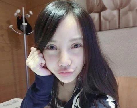 杨幂|从“大饼脸变成小V脸”的9位明星，杨幂说整了牙，金晨死鸭子嘴硬