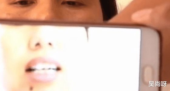 女子骑电动车摔掉7颗牙,怒找路边管理员赔偿,网友的评论两极分化