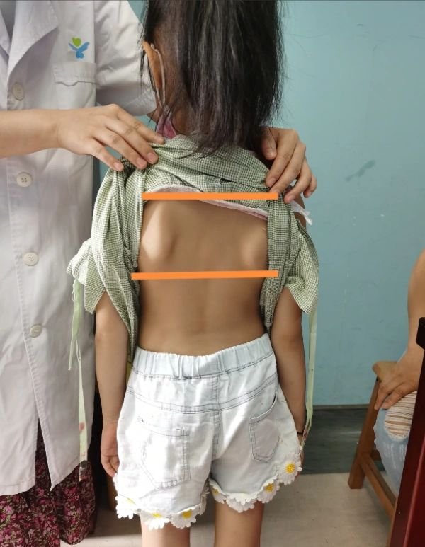 健脾|小孩不长肉，八神汤比四神汤，好太多，一个月长肉5斤