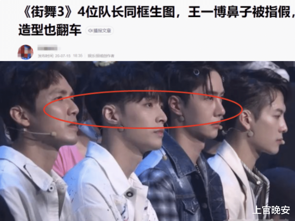 娱乐圈|娱乐圈明星们的假鼻子，真的绝了！都是狠人