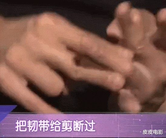 张小斐|欧阳奋强的下巴,刘亦菲的颈椎,明星风光背后,有多少难言的隐疾