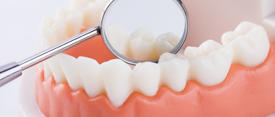 毛利率|耗材并非“天价”补牙的主因 但爱迪特要面对的问题也不仅是集采