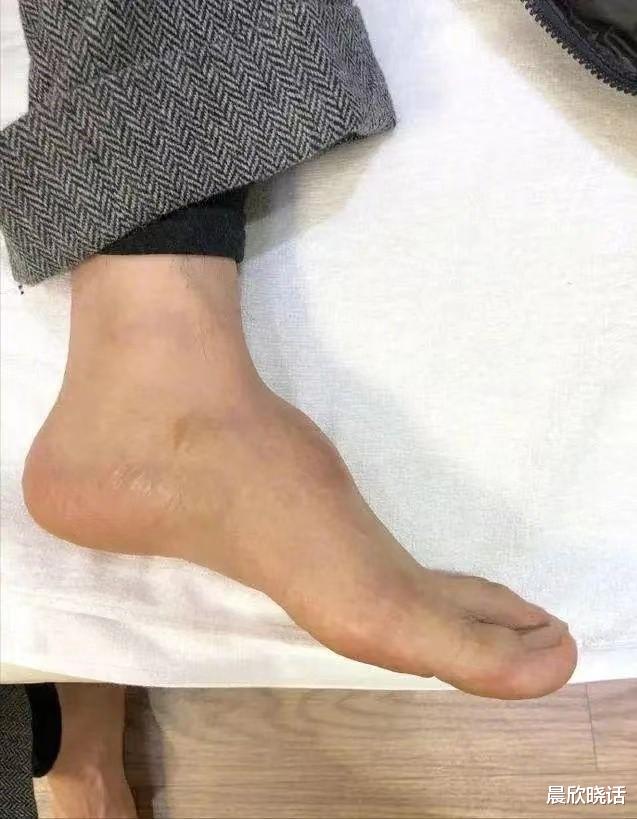 赵丽颖|谢霆锋的手，赵丽颖的血栓，张嘉译的背，打了多少明星的脸？