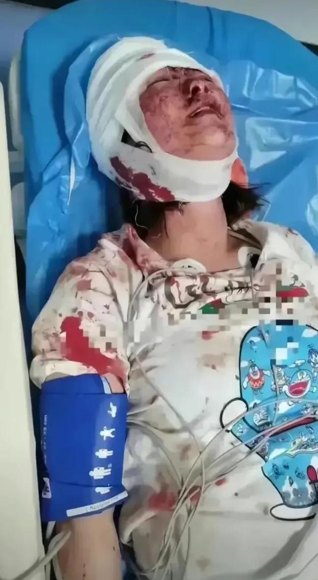 零容忍!河北率先严打,被打女子太冤,主犯找律师,唐山招生发愁