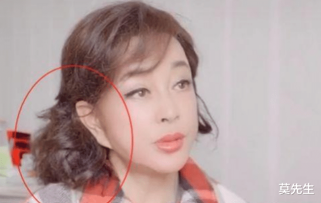 街拍|6位老年“整容脸”明星，面部僵硬、笑不出来、嘴歪，实在没法看