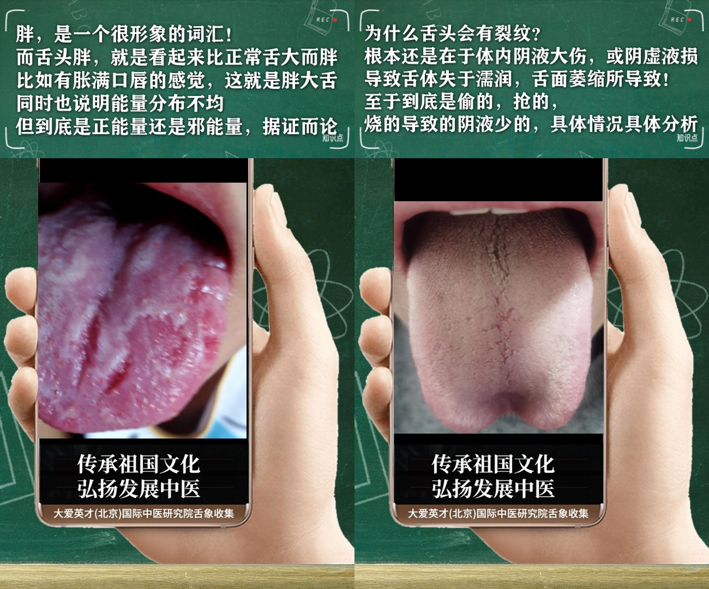 |中医实解:慢性胃炎,胃胀气,鼻子不通,胆胃上逆