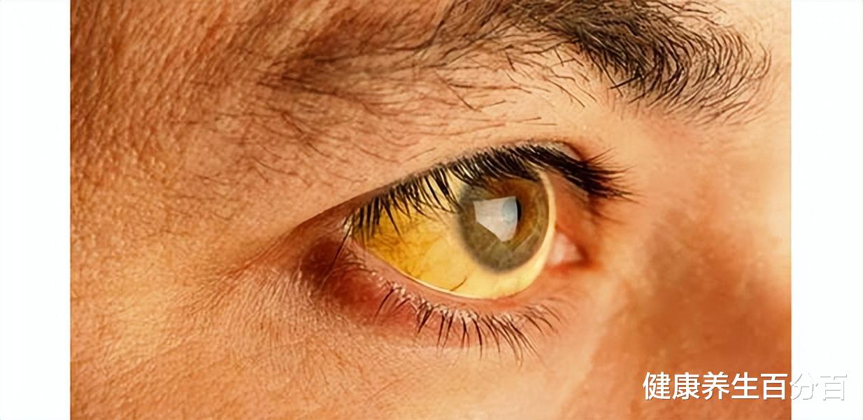 肝癌|乙肝表面抗原和抗体是阳性,代表什么?有包膜的肝癌术后会转移吗