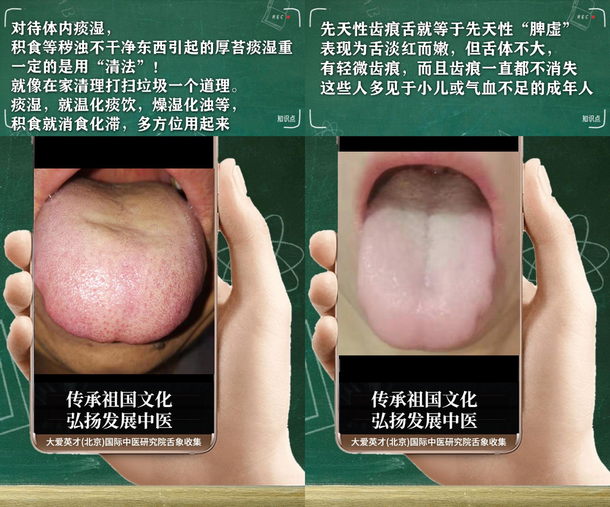 |中医解剖：常内心不安，容易出汗，鼻涕胶黏，时好时坏很难过