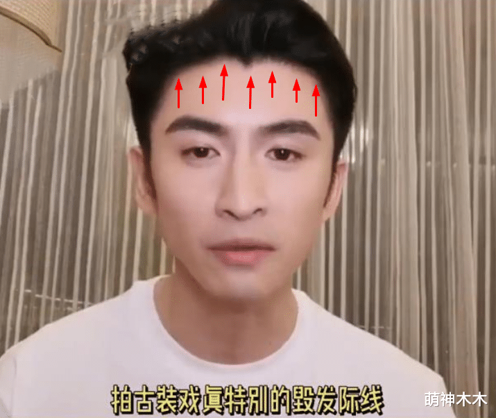 许凯|27岁许凯快秃了，发际线神似杨幂，二人合作偶像剧有望9月空降