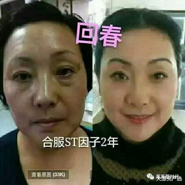 |精华液直接就往脸上抹？难怪你的皮肤会变差，这样做才是正确方法