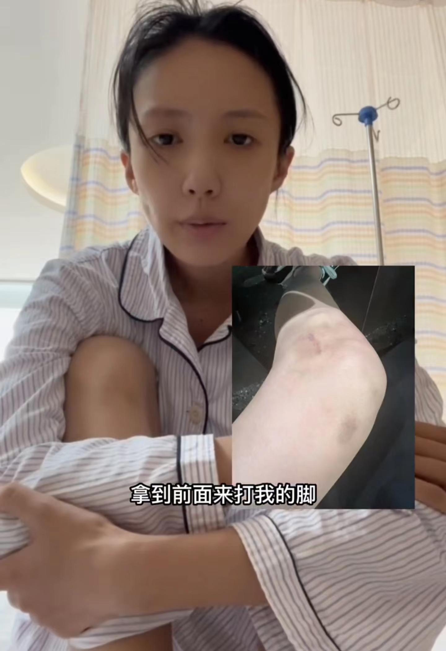 演员王东老婆遭公公殴打,小区撞车拖行六百米!