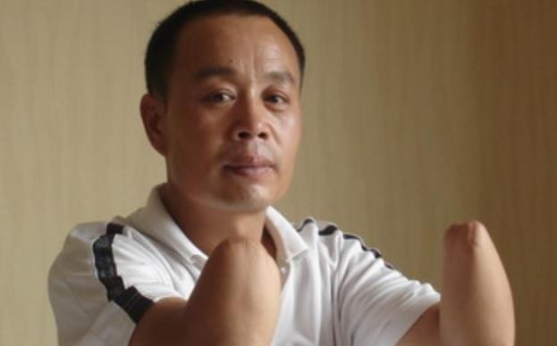 男子举报同村恶霸,却被报复砍掉双手,最终获赔金额少得可怜