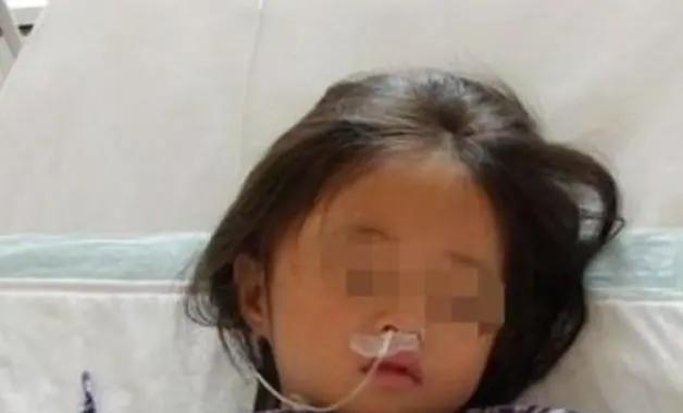 6岁女孩突然暴瘦,拍片时医生让娃摘掉“项链”,家长:娃没戴啊
