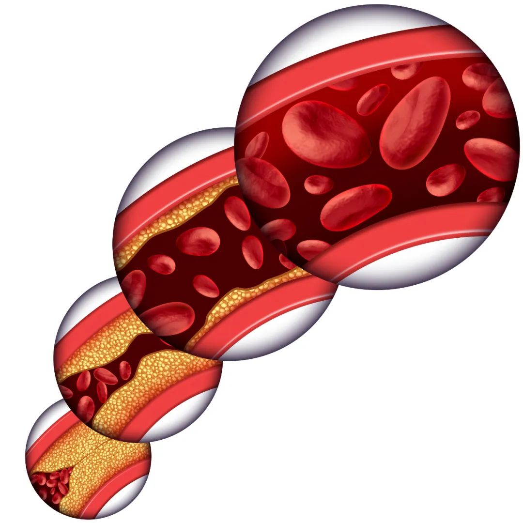 衰老|动脉——人体供给营养的管道!动脉衰老的过程是怎样的?