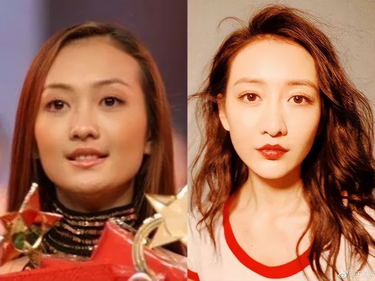 演艺圈|演艺圈“花式假下巴”大比拼，又尖又翘，一个比一个精彩