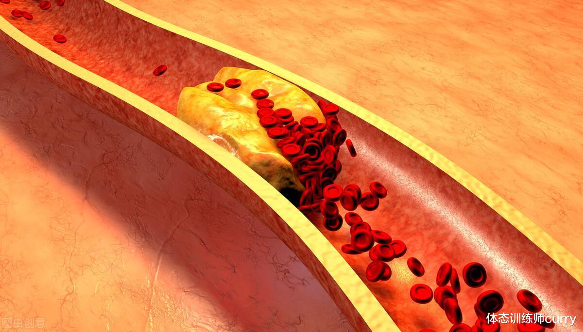 洋葱|“软化血管”坑了国人30年！什么红酒、洋葱、黑木耳，都是瞎扯