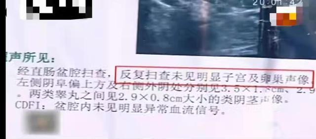 母亲怀孕吃打胎药,致使双胞胎儿子变成双胞胎女儿