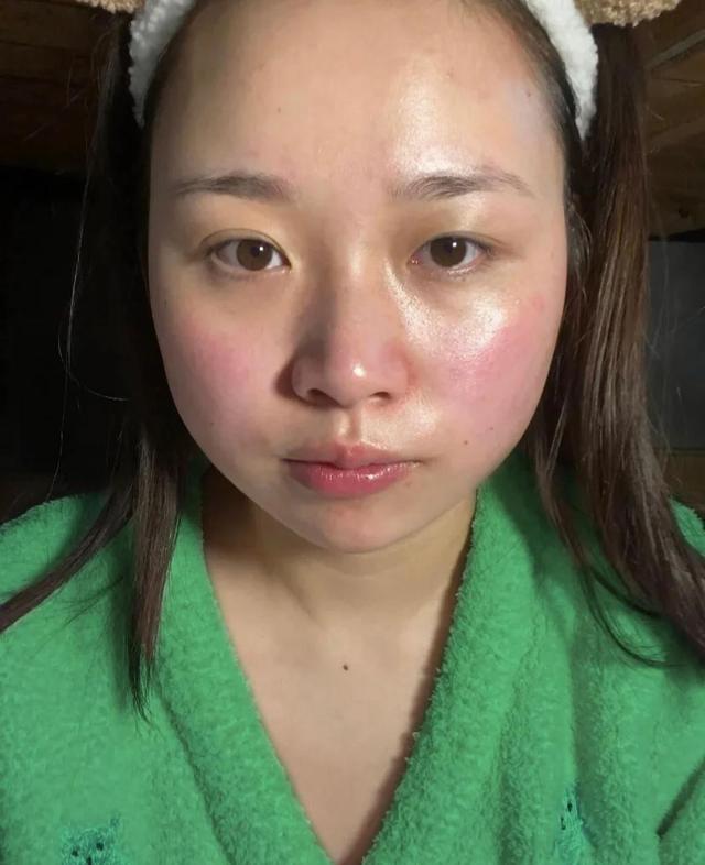 护肤品 判断你是“敏感肌”还是“伪敏感”，记住这几个明显特征，不会错