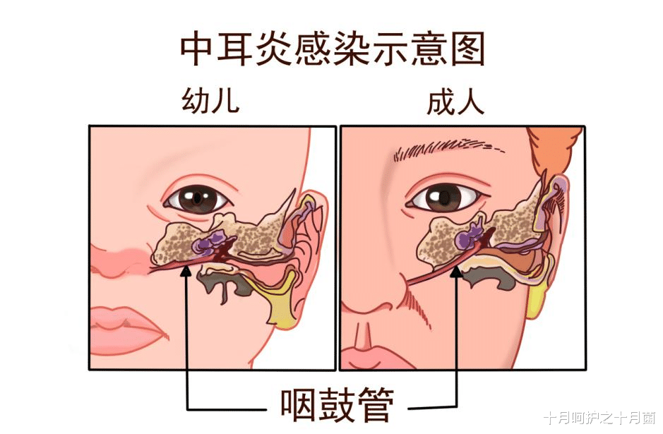 4岁男童从耳疼到面瘫仅一周,听力永久受损!竟因家长做了这件事,快停