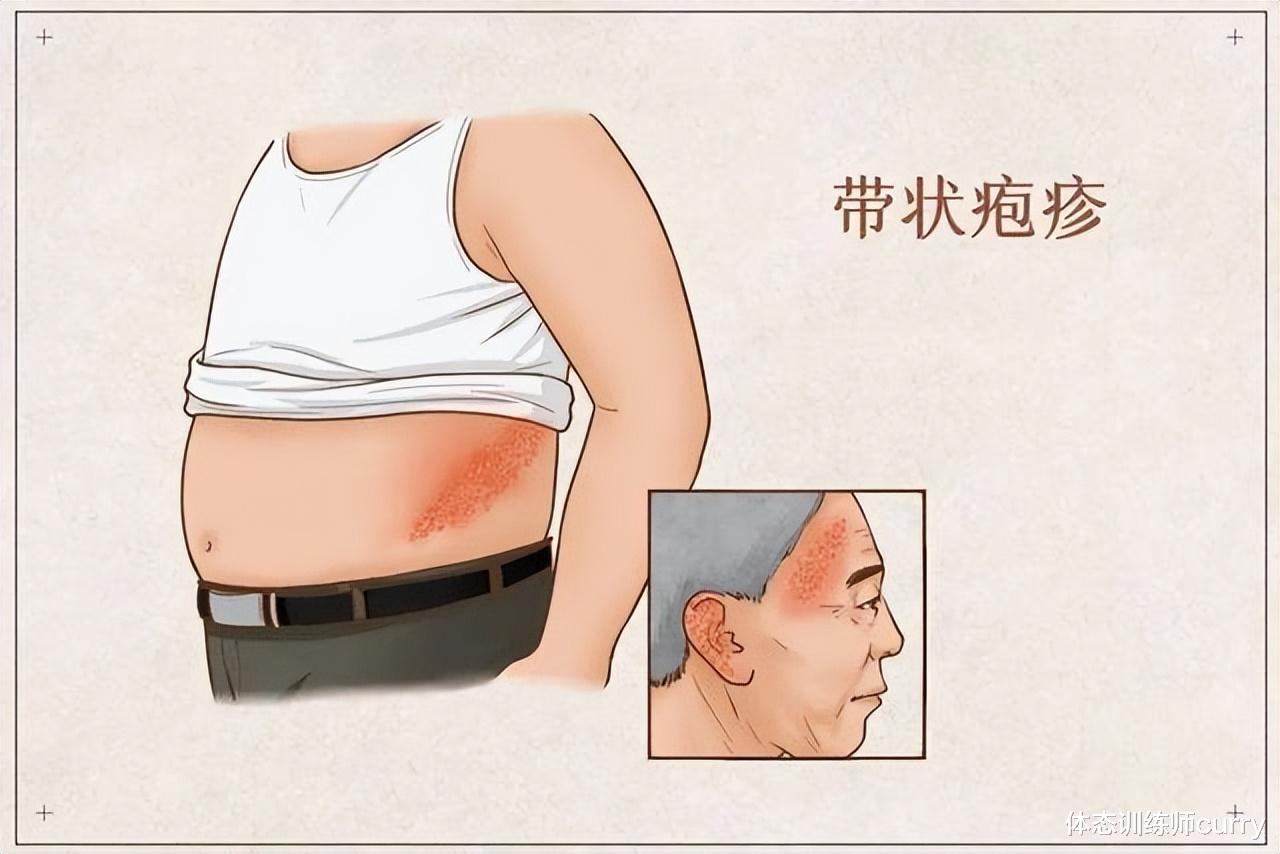 疾病|世界上最疼的病是什么?疼痛排名前5的疾病,经历过的都是王者