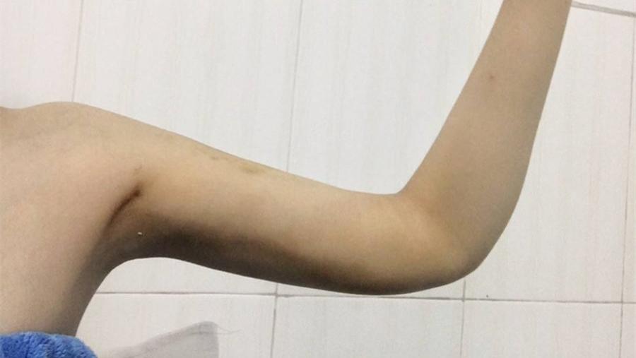 案例：女子腋窝毛发浓密，遭男友出言讥讽引发血案