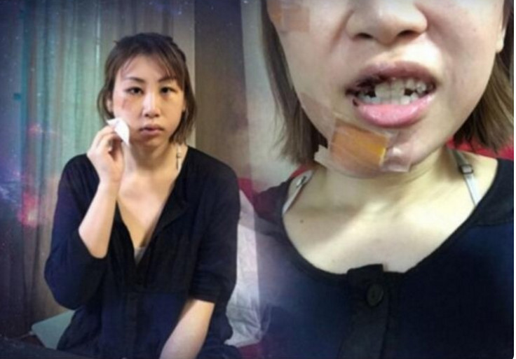 小姐姐|大家应该都知道,娱乐圈的明星大多数都整过容,朴诗妍也不例外