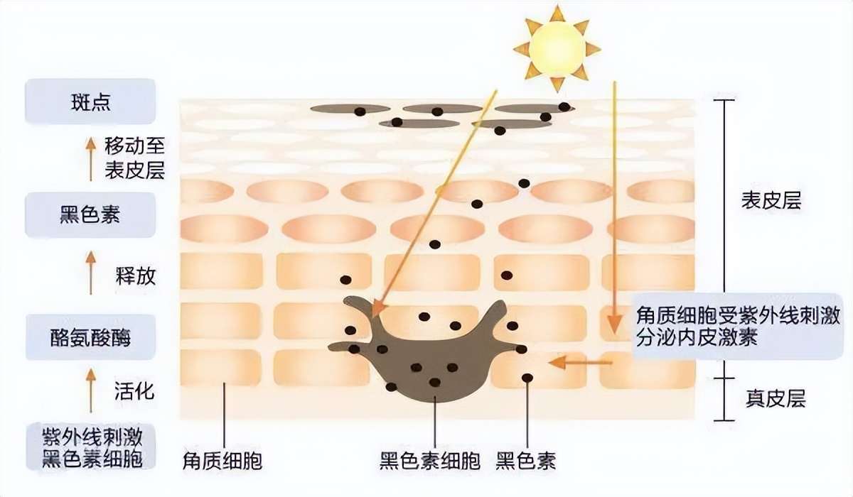 黑色素 美白新思路，弯道超车快人一步！