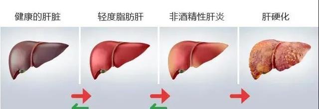 血脂异常|为什么压力和熬夜，对肝脏有致命伤害，背后的原因是什么？