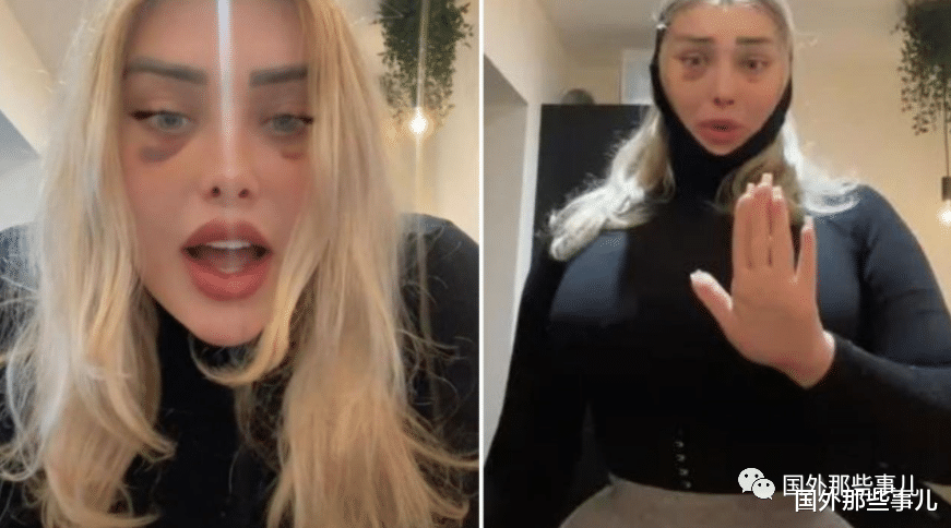 女网红做完整容手术搭飞机,脑袋直接“爆开”,鲜血从耳朵喷出