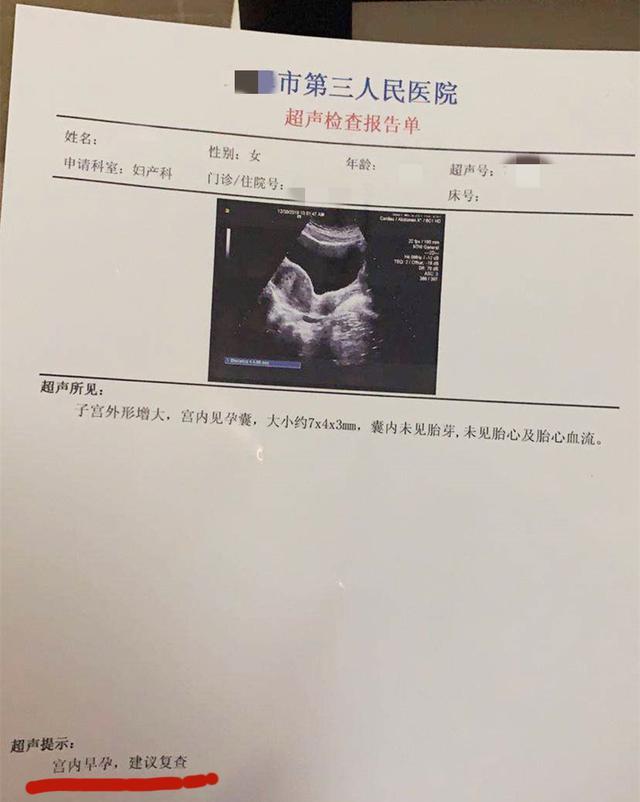 案例:52岁女子在女婿家怀孕,怕情人曝光,称被女婿侵犯酿悲剧