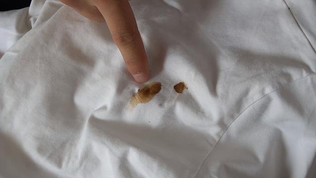 老婆例假连续来到二十七天,医生避开妻子,拉我到一边让我报警