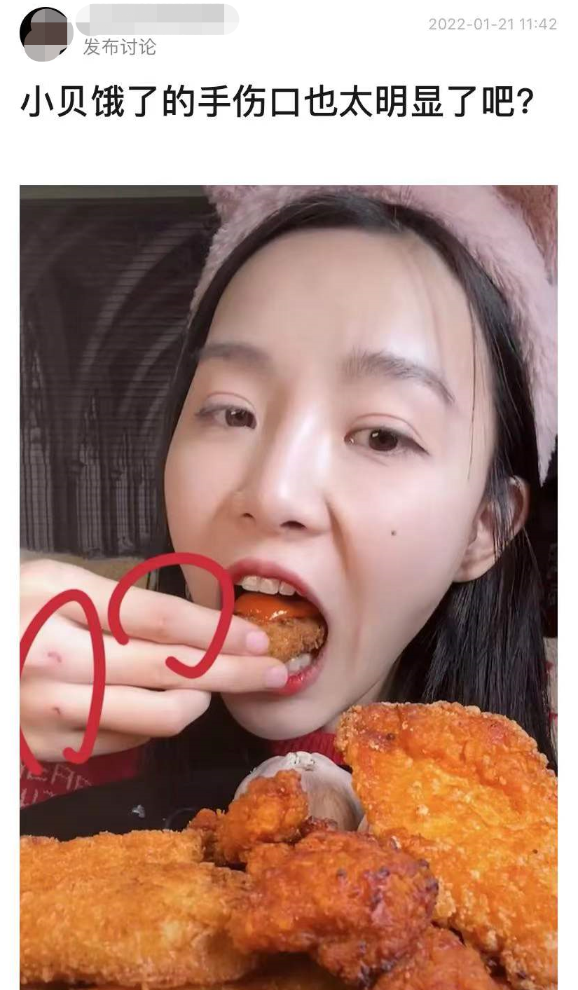 小贝|知名吃播小贝饿了又被指催吐，手指关节伤口似牙印，大批粉丝质疑