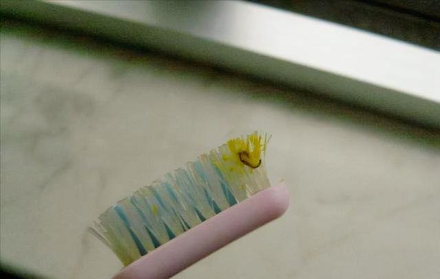 就因为家中出现这种虫子,他的眼球被摘除。快看看你家有没有