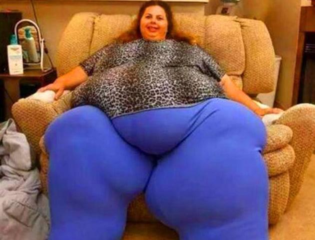 皮埃尔|苏珊娜：体重1000斤，双腿被压残疾，嫁英俊博士，育2个可爱儿子