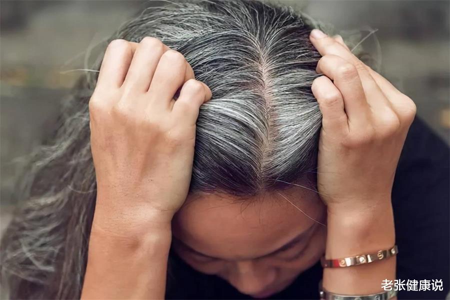 白发|白发不要急着染,多吃这4种食物,或有望改善