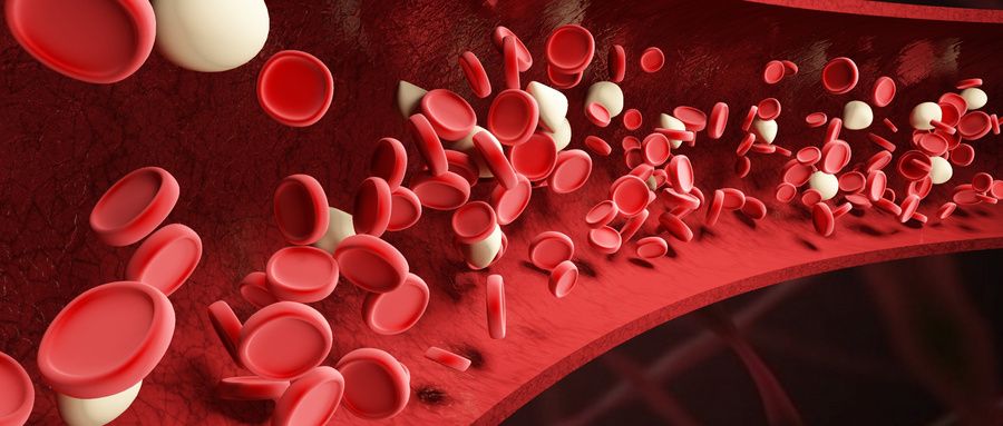 淋巴瘤|新型人工血管:破解再狭窄难题,具有广阔的临床应用前景