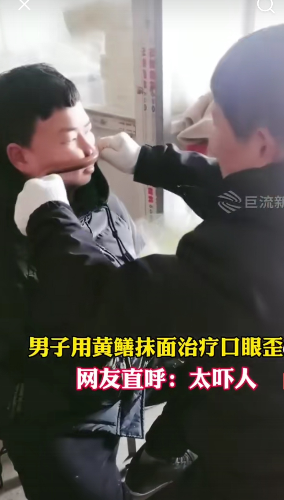 牧风芳华 小男孩得了面瘫,竟用这土法治疗,管用吗