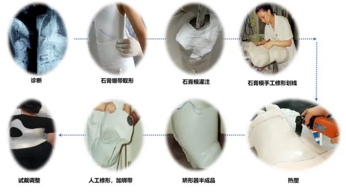 3D打印|粥多僧少？3D打印康复矫形器赛道的新机遇