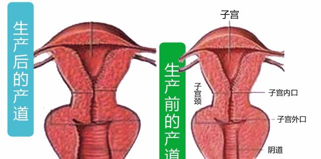 地球生物中,人类女性为何进化出狭窄扭曲的产道?直立行走代价