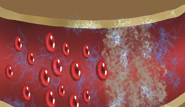 疾病|服用阿司匹林,容易出现这3个常见错误,阿司匹林能不能天天吃?