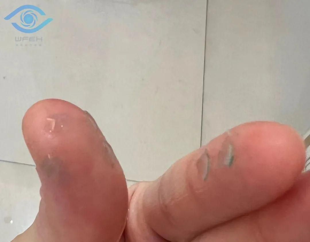 气温骤降,角膜塑形镜应该如何保暖?