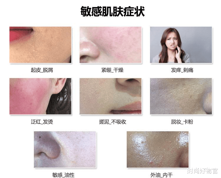 面霜|护肤课堂:什么是敏感肌?解决方法是啥?