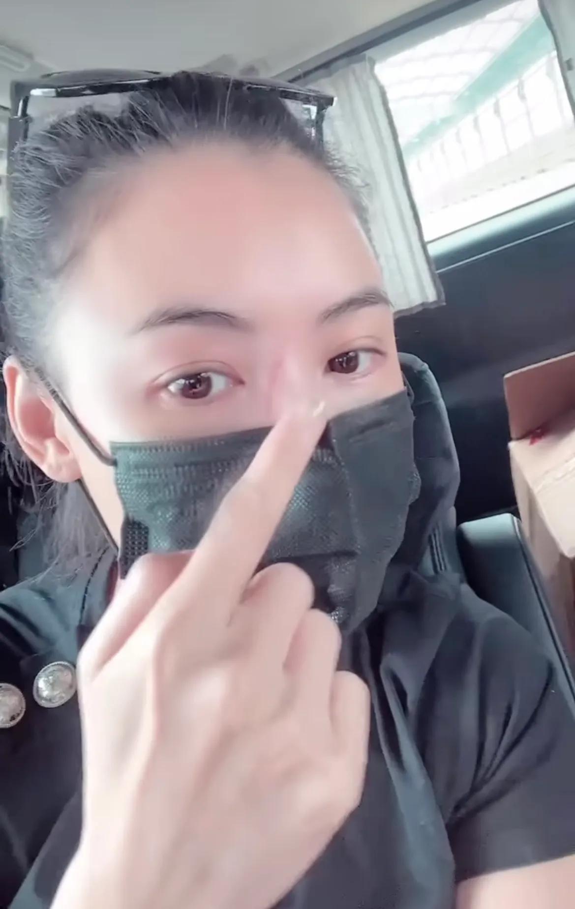 秦岚|张柏芝透露被3岁小儿子抓伤脸，伤口很长遮不住，自称“刀疤张”