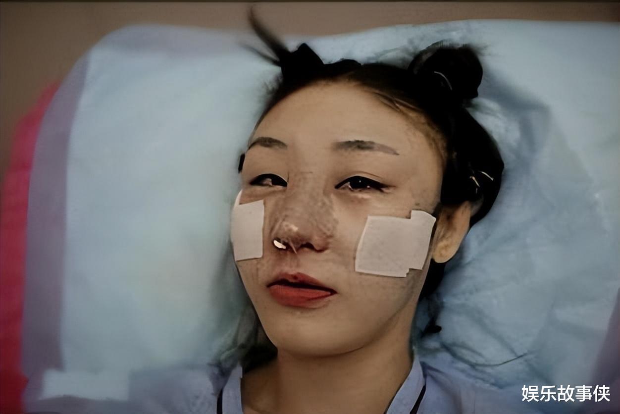 澳洲一女子把自己整成“真人版芭比”,外表怪异,让人难以理解