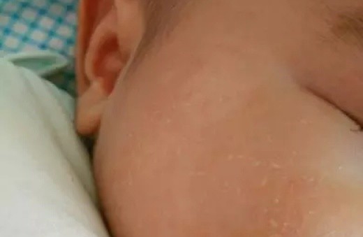 水果 夏季热门婴儿面霜排行榜|补水保湿一瓶搞定，拯救宝宝苹果脸！