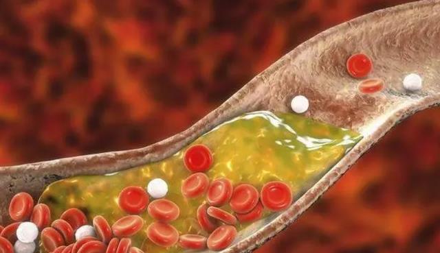 痰液|91岁陈院士,研究血脂50多年,提醒:除了肉,这3种蔬菜也要少吃