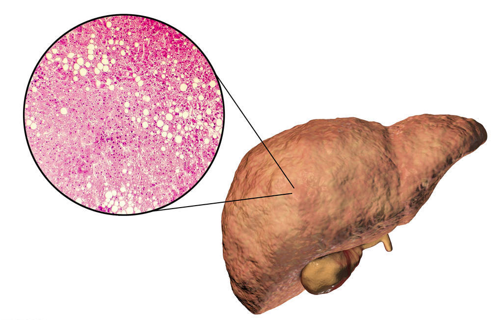 过敏|肝脏最不能忍受的7种行为,饮酒不是最伤肝的,情绪也可影响