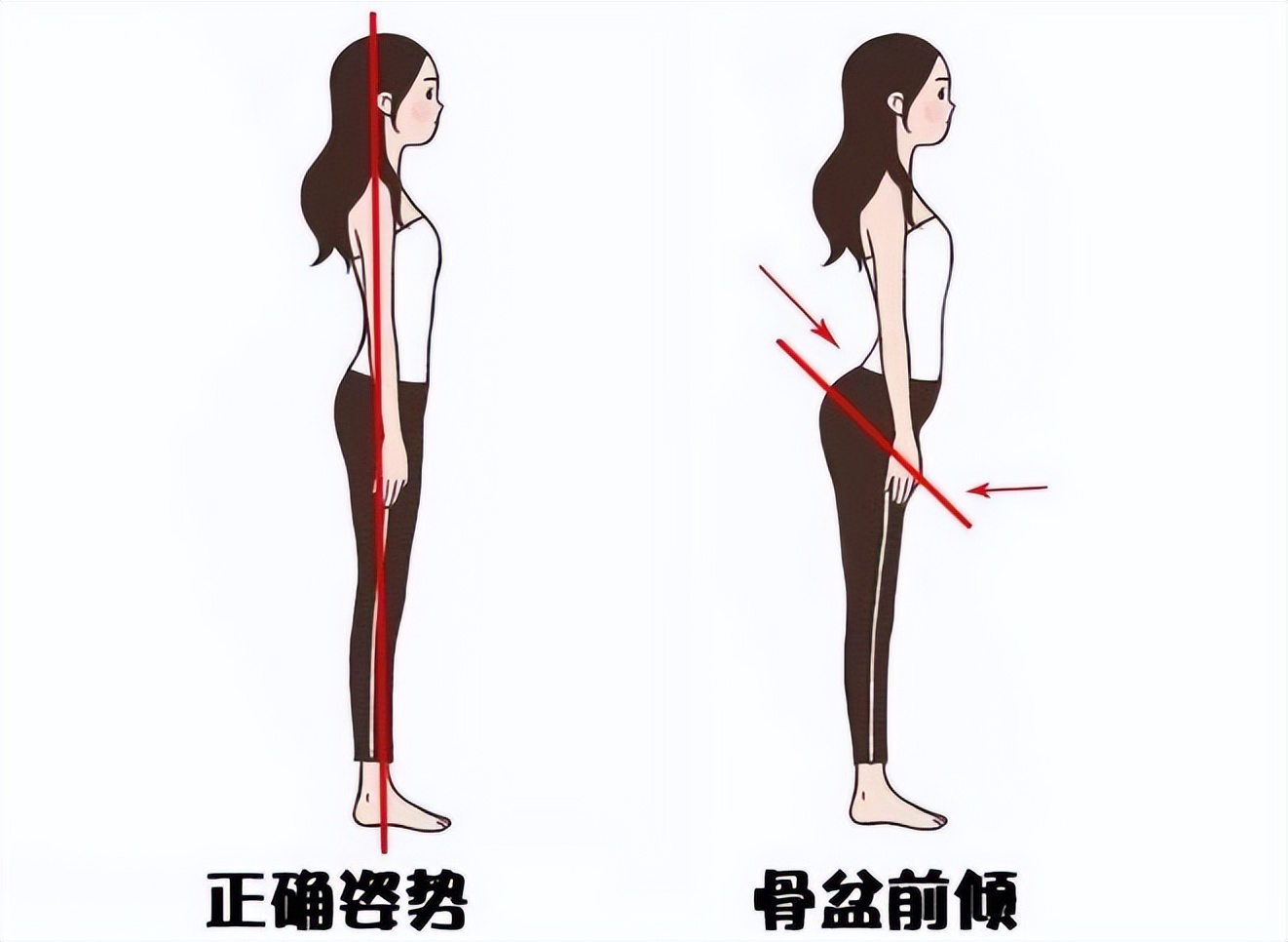 白发|「体态改善」大部分人都有的体态问题，看完自己评估一下